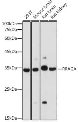 Western Blot: RRAGA Antibody [NBP2-94546] - Western blot analysis of extracts of various cell lines, using RRAGA antibody (NBP2-94546) at 1:1000 dilution. Secondary antibody: HRP Goat Anti-Rabbit IgG (H+L) at 1:10000 dilution. Lysates/proteins: 25ug per lane. Blocking buffer: 3% nonfat dry milk in TBST. Detection: ECL Basic Kit. Exposure time: 30s.